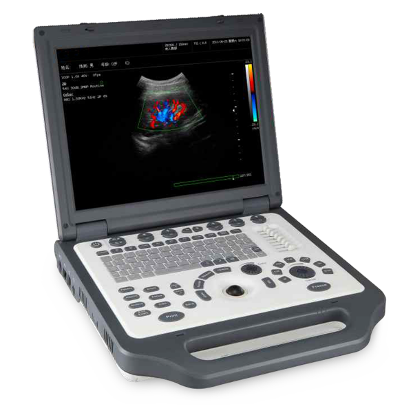 Doppler Veterinario de Color de Computadora Portátil