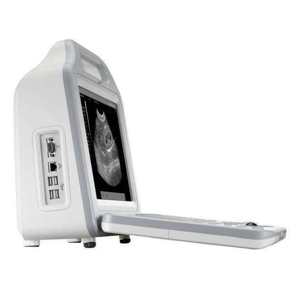 Ultrasonido portatil